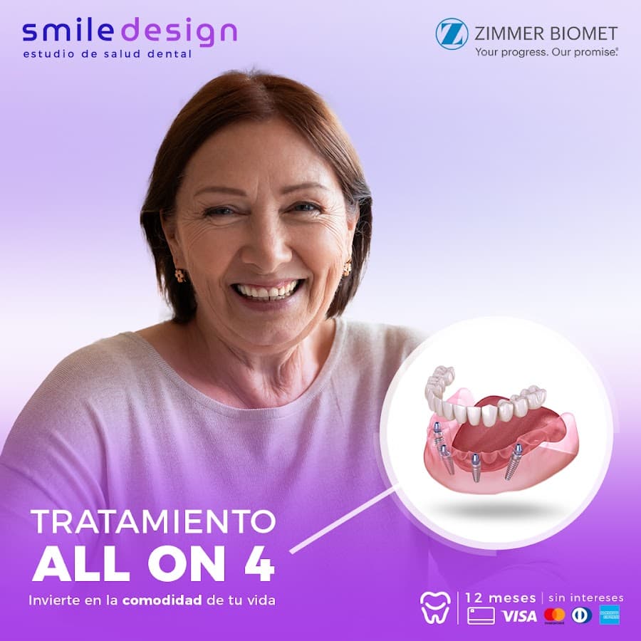 Smile Design Quito Estudio de Salud Dental — foto