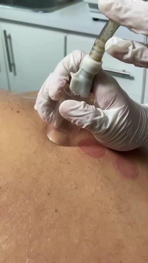 Cryo Esthetics Siluet Spa en Bucaramanga & Centro de Estética — foto