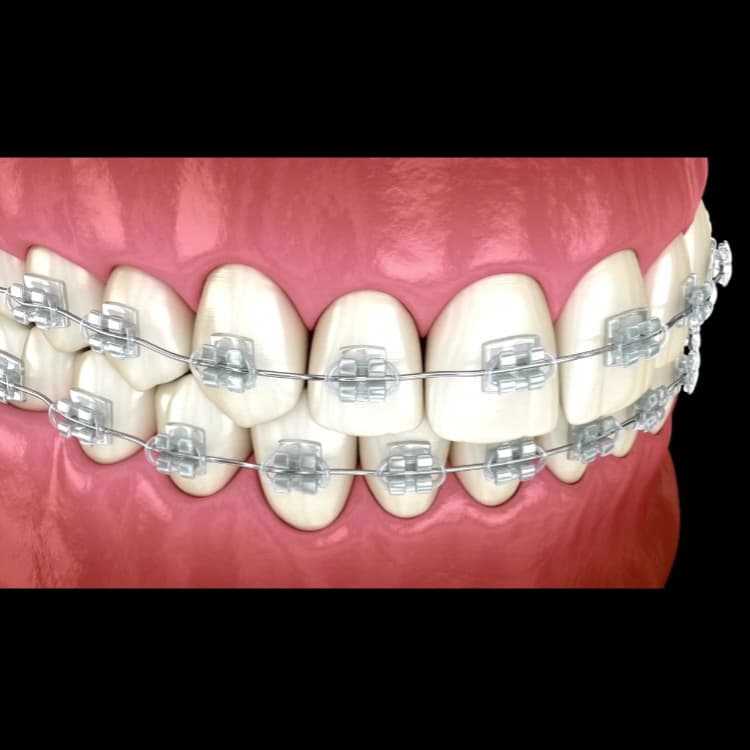 PREDENTE Clínica Odontológica - Implantes Dentários, Próteses, Alinhadores Invisíveis — foto