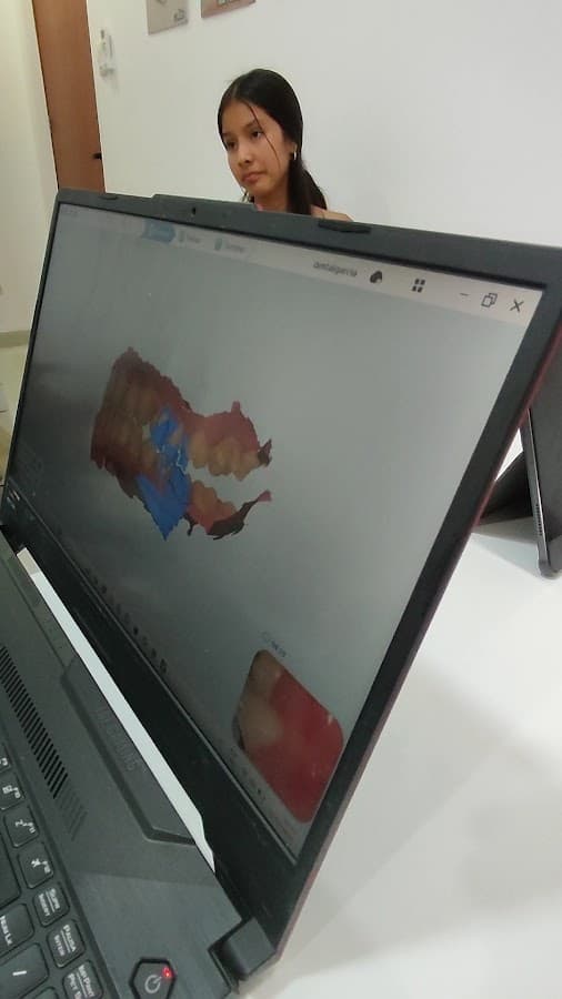 Odontologo | Centro Oral Piura | diseño de sonrisa brackets — foto
