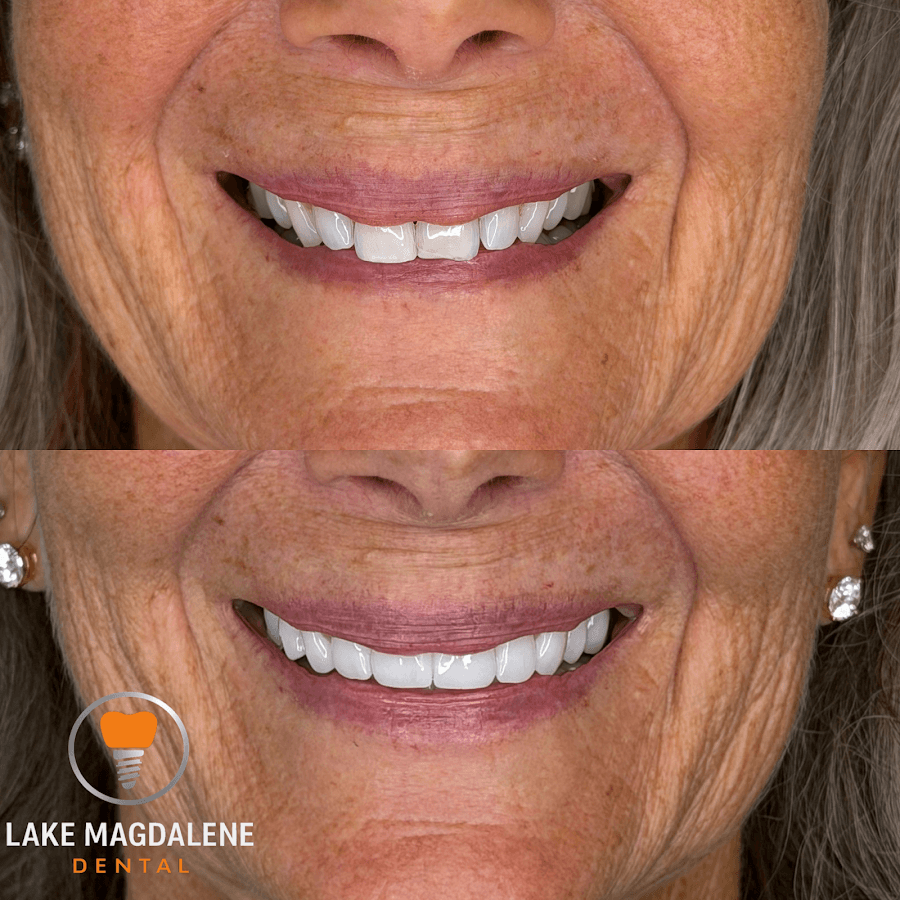 Lake Magdalene Dental — foto