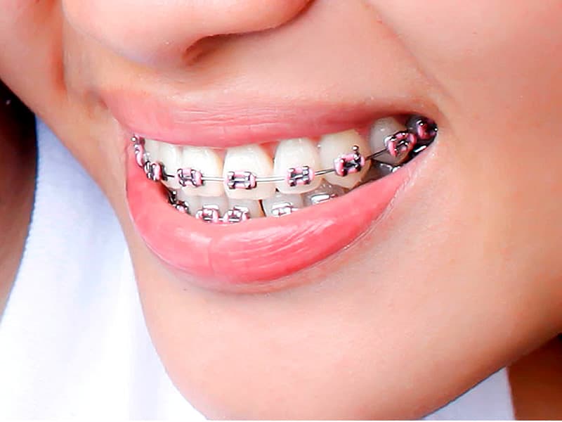 Odontoimagen — foto