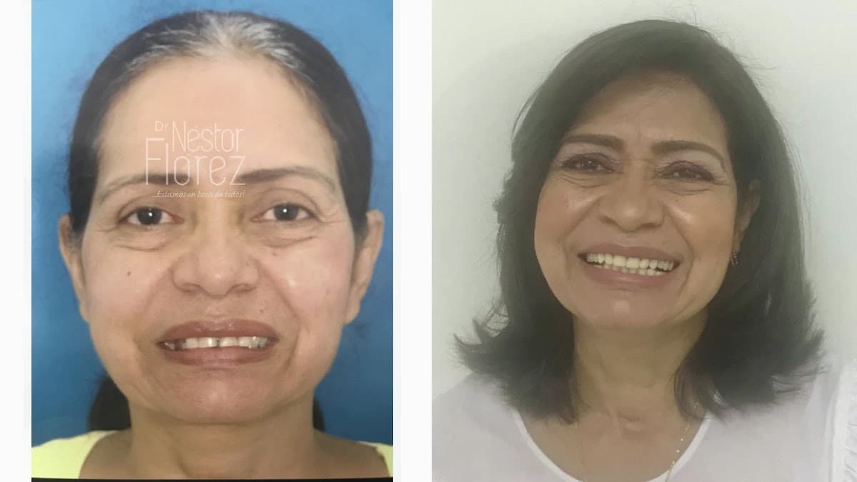 Dr Nestor E Florez .Odontologia Santa Marta — foto