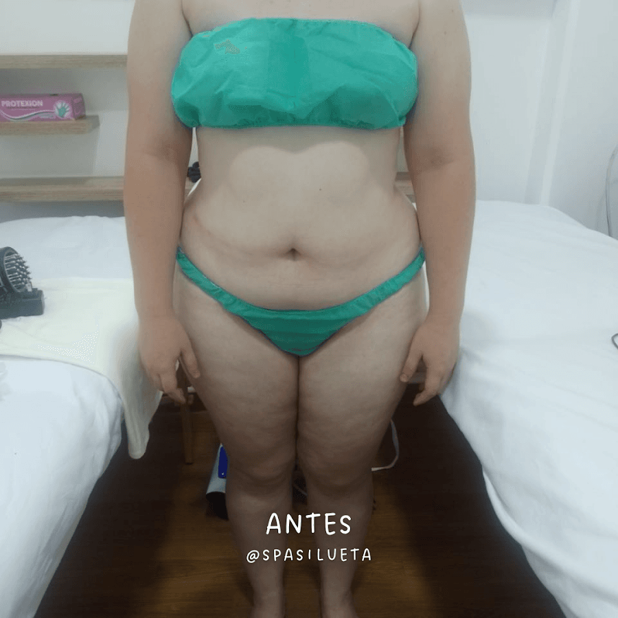 SPA y Estética Silueta Estética Integral — foto