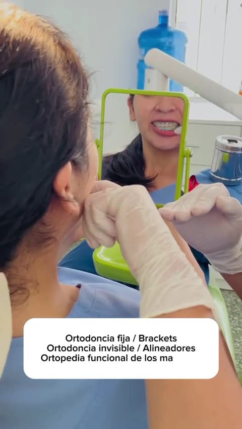 Clinica dental E&M- Carillas Dentales - Brackets -Implantes Dentales - Profilaxis Dental — foto